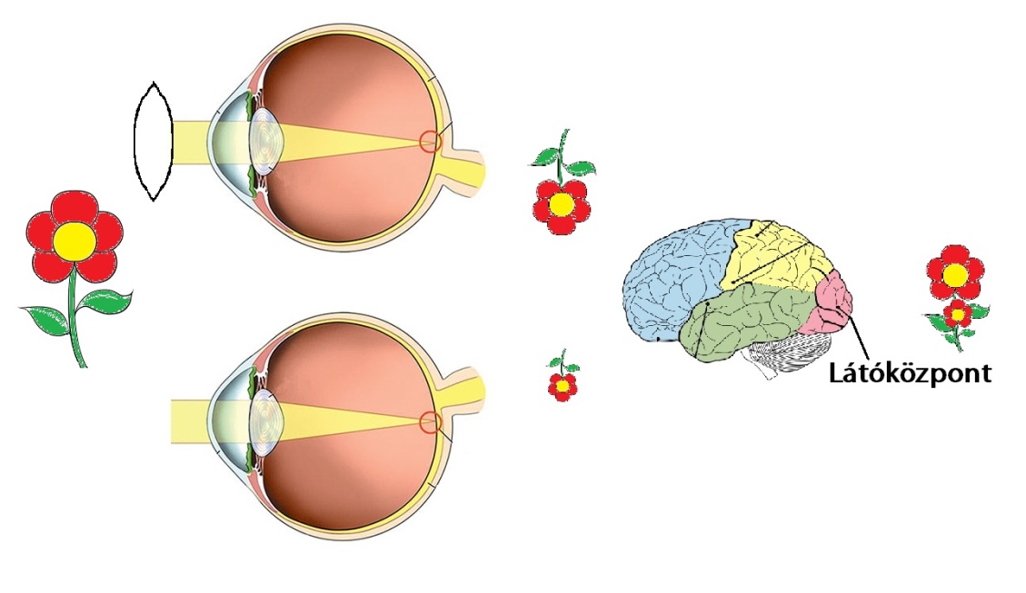 a látásbetegségekről tanakan látássérülés esetén